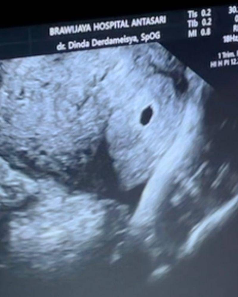 Instagram.com/t_orasudi_ro